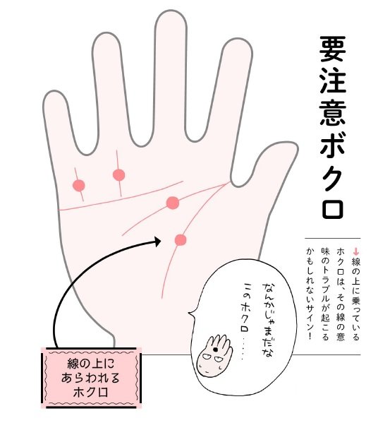 生命線や知能線に乗っかるホクロ 見つけたら要注意 ざんねんな手相 Esseonline エッセ オンライン