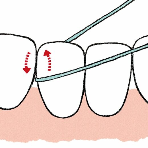 フロスを歯に引っかけて汚れをかき出す様子