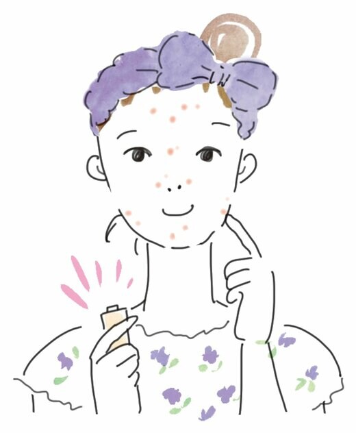 ニキビに治療薬を塗る女性のイラスト