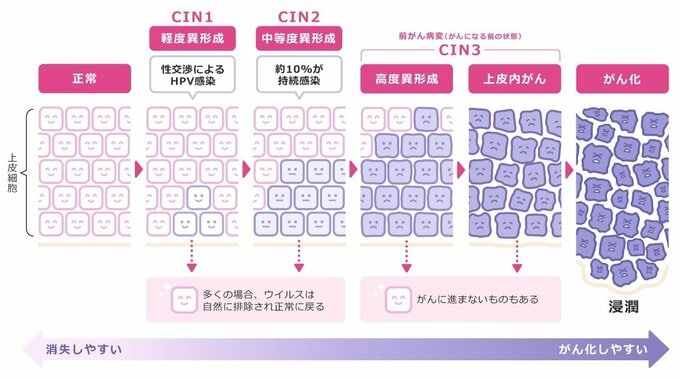 がん化の図解