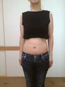 お試しビフォー