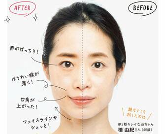 たった10秒でマイナス5歳！ほうれい線のたるみには「頭ほぐし」