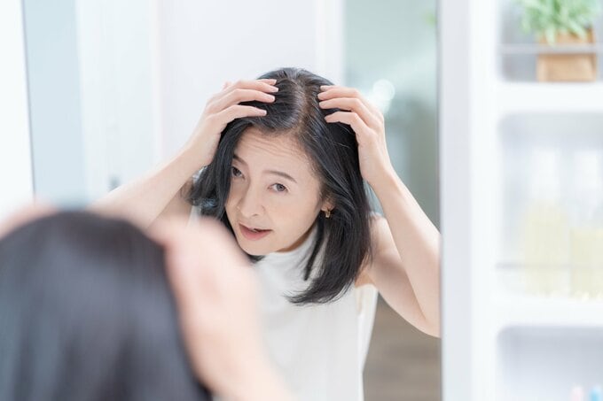 髪の毛の生え際が気になる女性