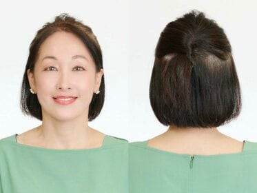 大人のヘア問題白黒つけます