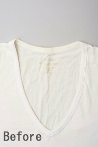 薄い黄ばみが首回り一帯に