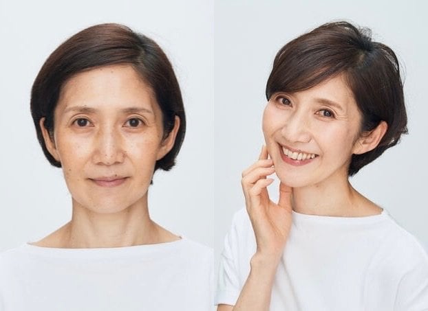 ビフォーアフター