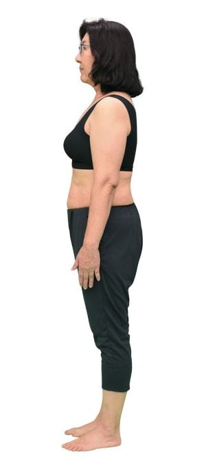 山田道子さんAFTER