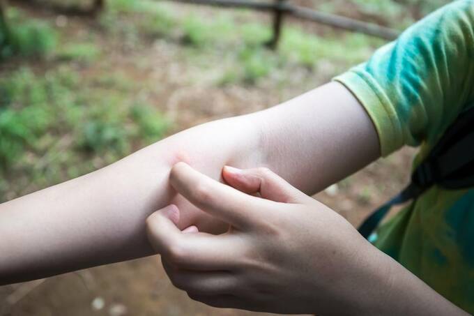虫刺され腕をかく様子