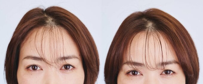 前髪アップ比較