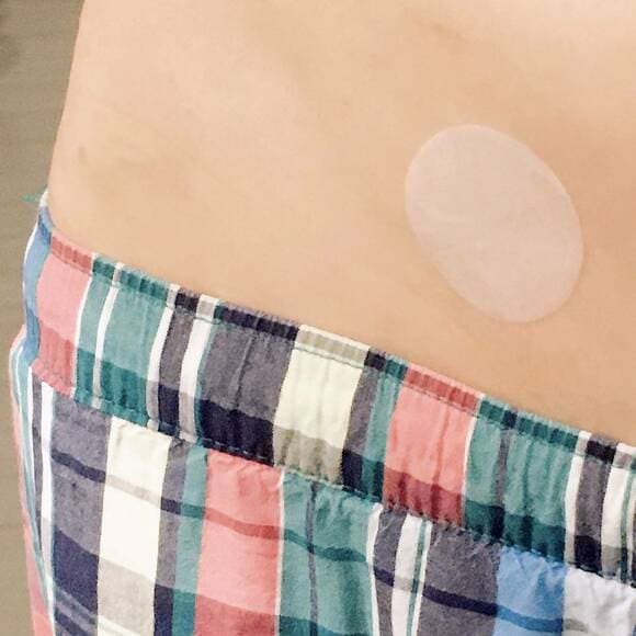 パッチ剤をはった様子