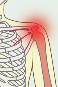 こわばった肩関節を刺激する