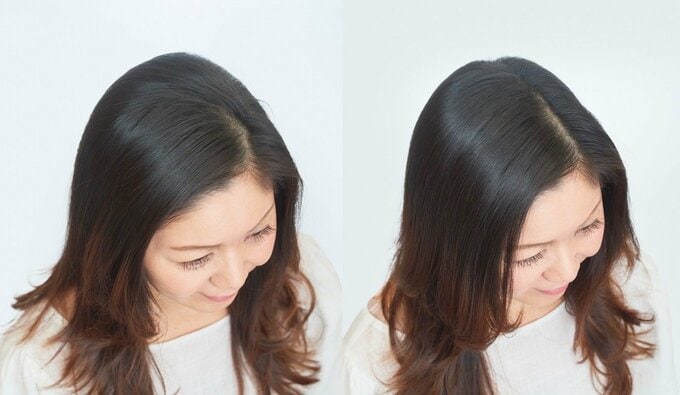 女性の頭頂部の比較