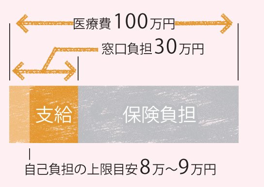 高額医療費制度