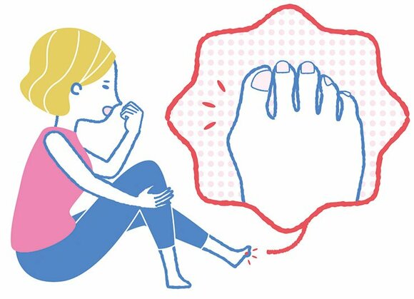 足の爪が変形している、またはタコ、外反母趾がある