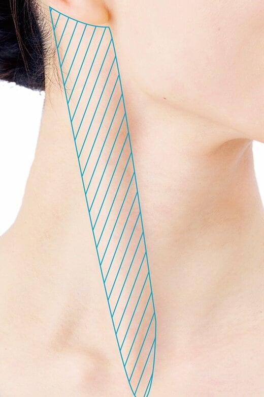 耳の後ろから鎖骨にかけて浮き出る胸鎖乳突筋