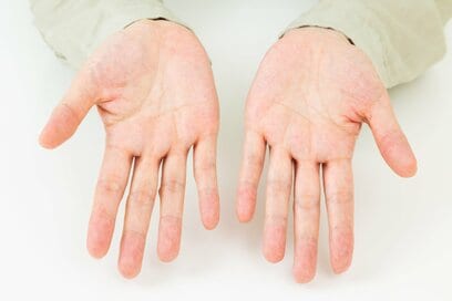 「懸賞運」が強い手相って？当たる手相のつくり方4つ