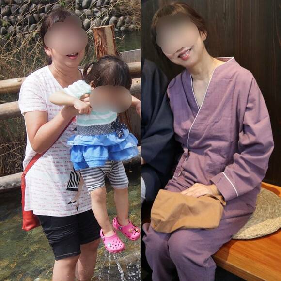 ビフォーアフター