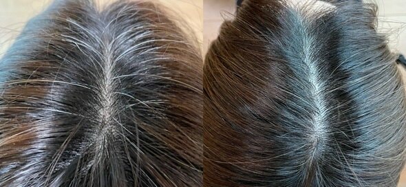 話題の「脱白髪染め」を自力でお試し。お金をかけずに白髪は目立たなくなるのか！？