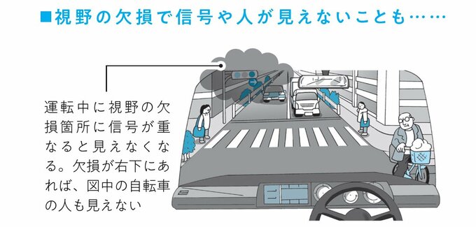 視野の狭い人の運転